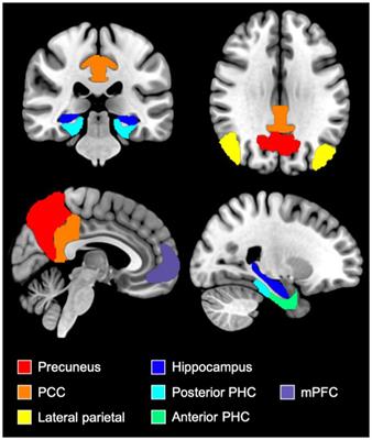 Altered resting-state functional connectivity patterns in late middle-aged and older adults with obstructive sleep apnea